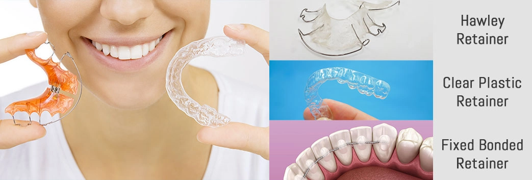 invisalign