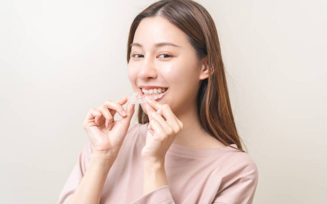 How Much Does Invisalign Cost in Australia?