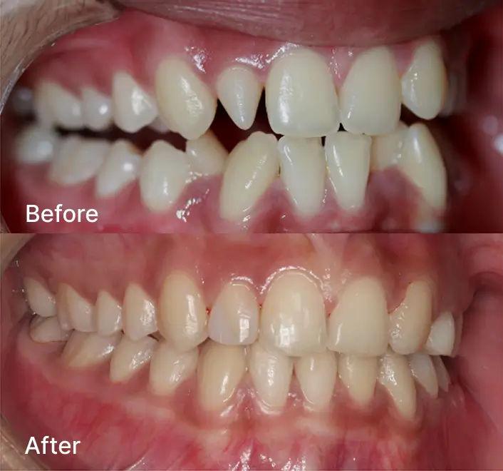 Orthodontics Case