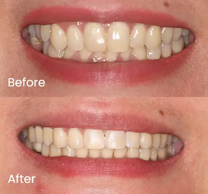 Orthodontics Case