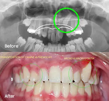 Orthodontics Case