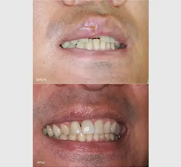 Trauma Case 2
