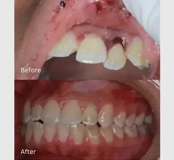 Trauma Case 1