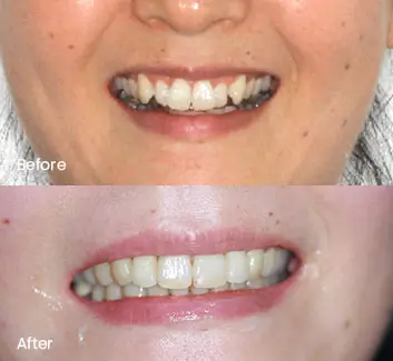 Orthodontics Case 40