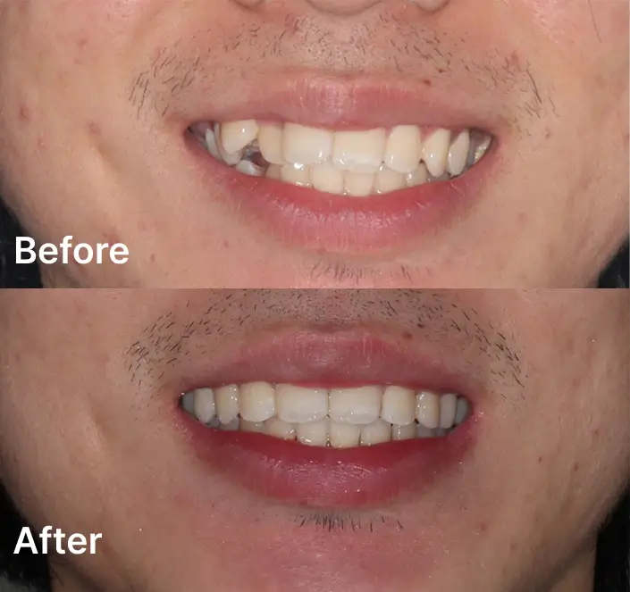 Orthodontics Case Carindale