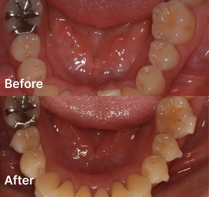 Orthodontics Case
