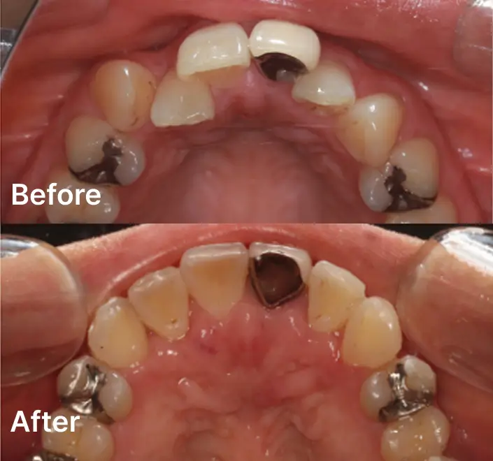 Orthodontics Case