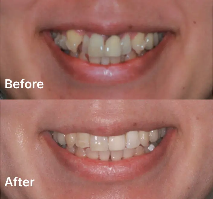 Orthodontics Case