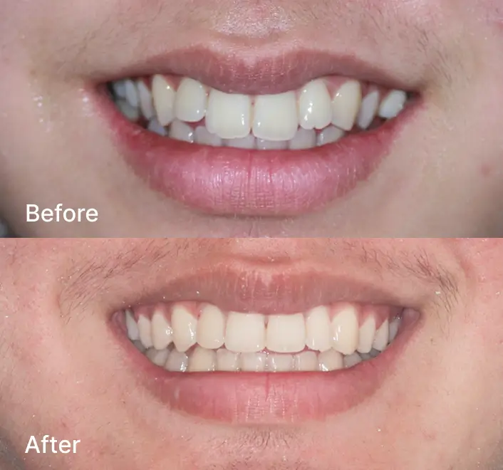 Orthodontics Case 2
