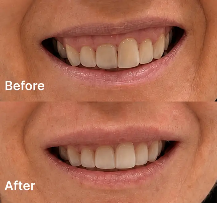 Before and after cosmetic dental treatment results