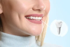 implant abutment and crown in patient implant abutment and crown in patient