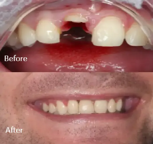 Trauma Case 4